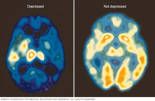 Neurogenesis & Synaptogenesis: How to bring under-connected areas of the brain back online.